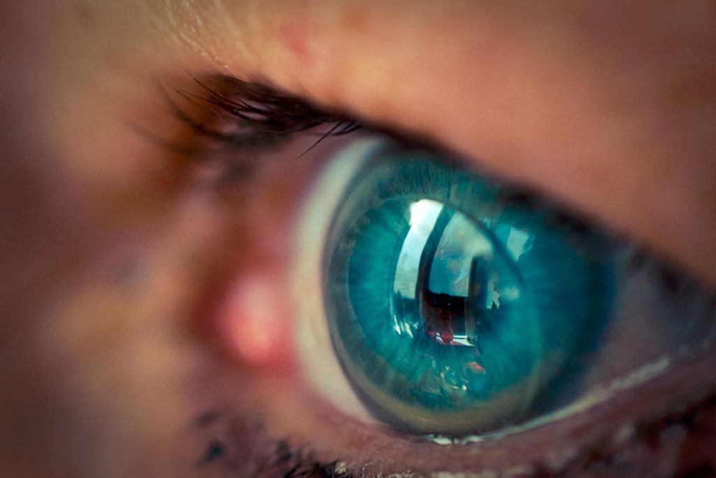 ترفندهای نگهداری از لنز تماسی از زبان یک کارشناس