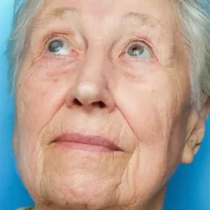 درباره قوزقرنیه و راه های درمان ان بیشتر بدانید