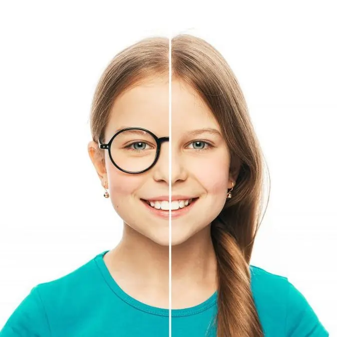 مزایای استفاده از لنز چشم برای نوجوانان