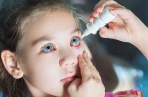 قطره های چشمی تسکین دهنده آلرژی