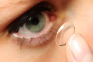 لنزهای چشم پس از لیزیک